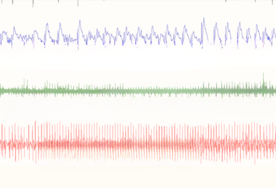 EEG