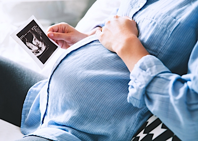cropped shot of pregnant woman holding ultrasound photo