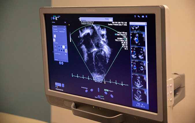 Echocardiogram on monitor, scan of heart and arteries