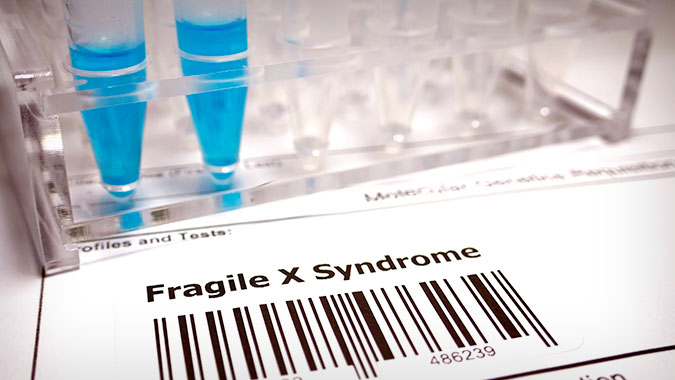 Fragile X specimen test, stock