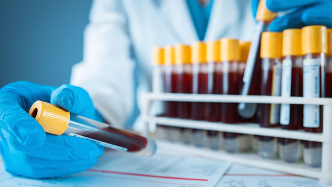 blood vials for research, stock image