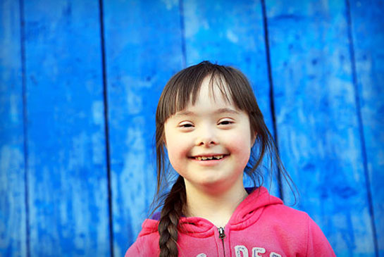Downe syndrome child patient smiling. 