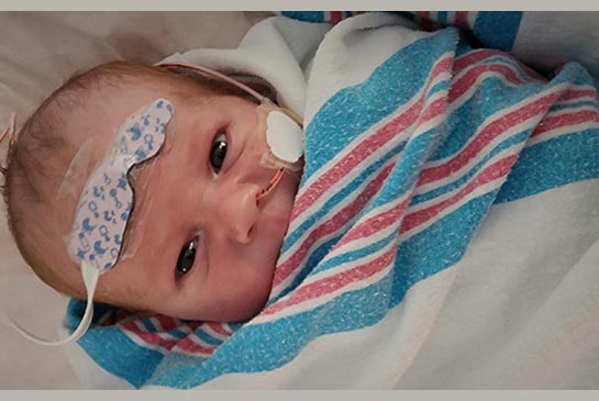 Baby cardiology patient, Vincent Dover, recovering in NICU.
