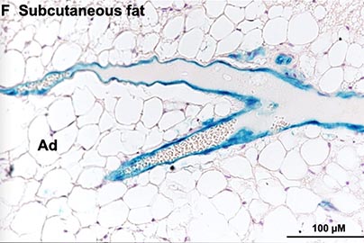 Subcutaneous Fat image, under microscope