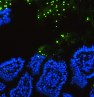 Pre and postbiotics under magnification, green and blue cellular patterns.
