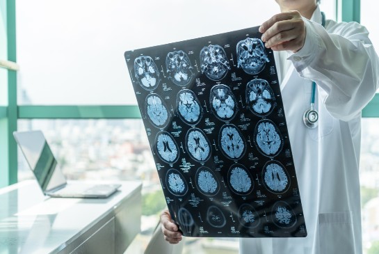 A researcher holds up images of the brain