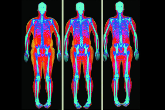 Three multicolored images of a body scan.