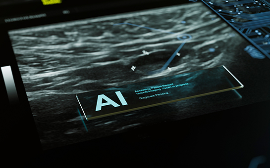 $16 million study examines AI’s  role in reading mammograms