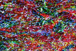 microscopy image of pacemaking tissue; the image resembles a Jackson Pollock painting