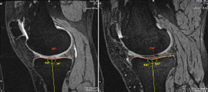 joint imaging