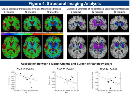 PRE-CELL MRI brain scans