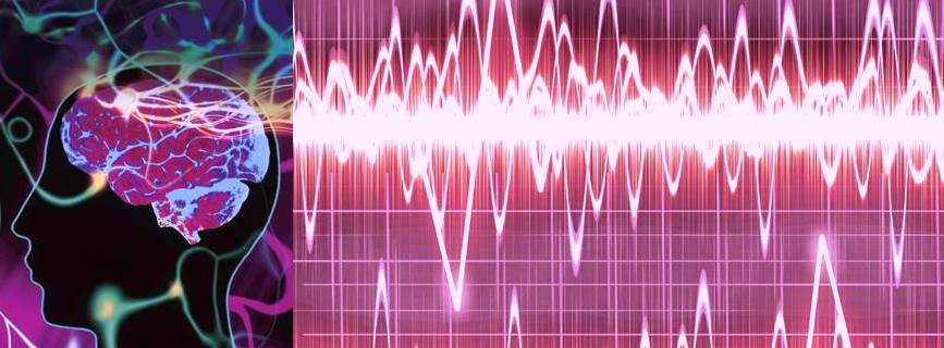 UC Davis Neurology Epilepsy Seizure