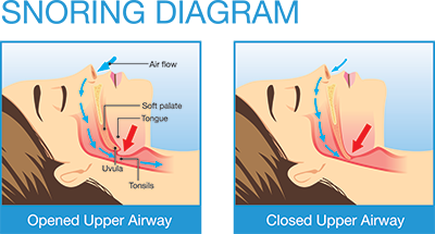 UC Davis Health, Department of Otolaryngology