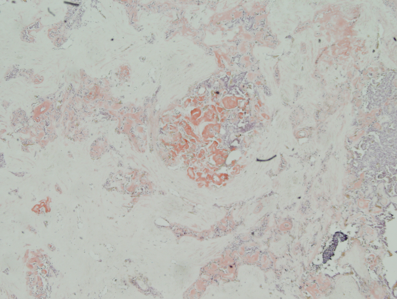 COTM August 2010 Immunohistochemical stains: Figure 1 of 2