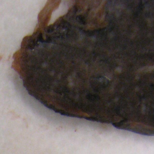 Figure 2. Fragment of the splenectomy specimen.
