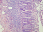 Microscopic image 10: Appendix (Click to enlarge)