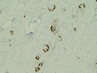 Microscopic image 11: Appendix, Chromagranin (Click to enlarge)