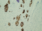 Microscopic image 13: Appendix, CK-20 (Click to enlarge)