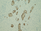 Microscopic image 14: Appendix, MUC-2 (Click to enlarge)