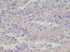 Microscopic image 3: Ovary (Click to enlarge)