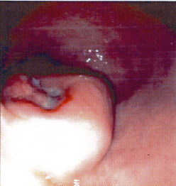 Case of the Month, Jan. 2013: Figure 1