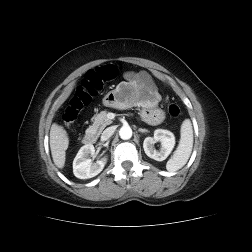 Case of the Month, Jan. 2013: Figure 2
