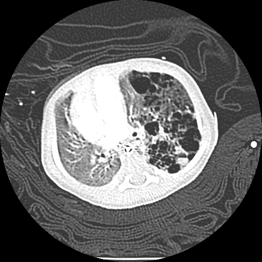 Case of the Month, Feb. 2013: CT 1