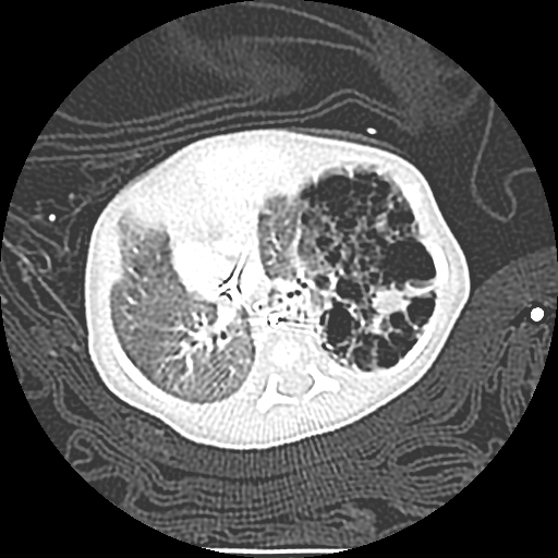 Case of the Month, Feb. 2013: CT 2