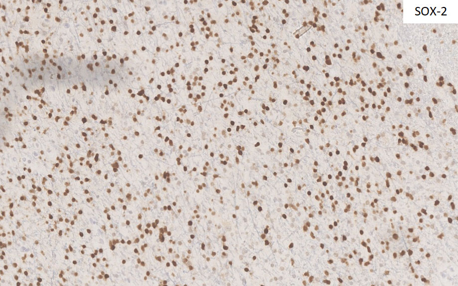 Figure 4: Immunohistochemical stains at 10x.
