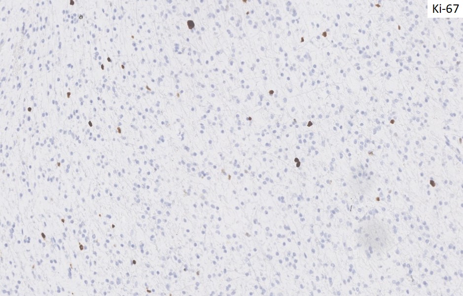 Figure 7: Immunohistochemical stains at 10x