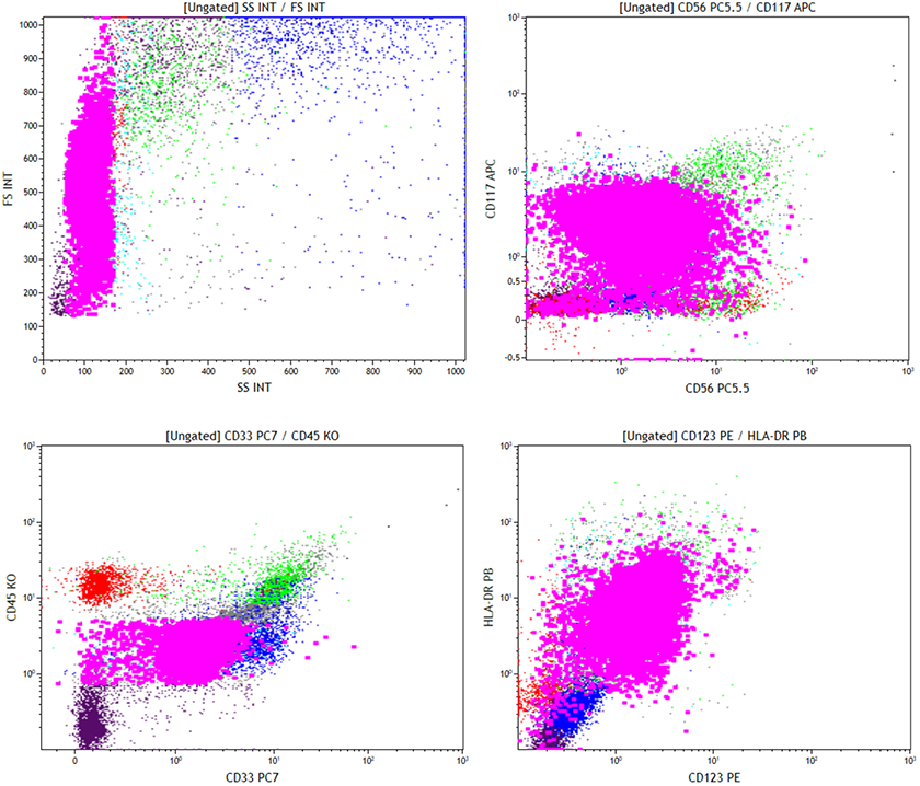 FLow cytometry showed the abnormal population to be positive for CD56, CD123, HLA-DR, CD33, and CD117