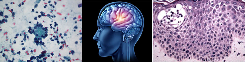 Surgical Pathology page banner