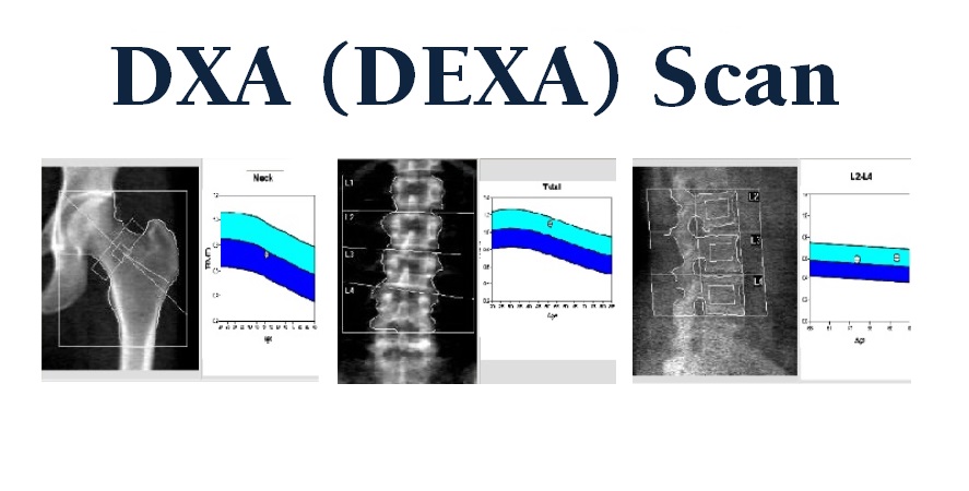 DEXA Scan Department Radiology UC Davis Health
