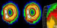 UC Davis Health's new ultra-high-resolution CT scanner