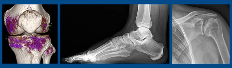 Musculoskeletal radiology scan images