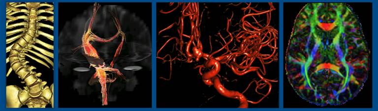 neuroradiology scans