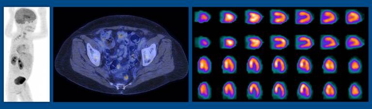 Nuclear Medicine | UC Davis Department of Radiology