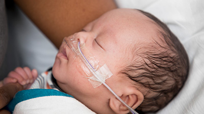 Young pediatric baby, UC Davis Health